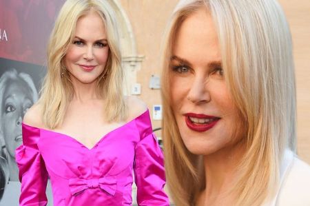 A before and after plastic surgery photo of Nicole Kidman.